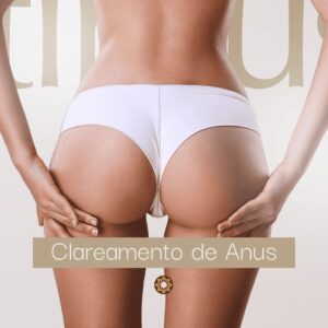 Clareamento Anal a Laser