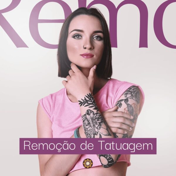 Remoção de Tatuagem a Laser