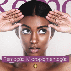 Remoção de Micropigmentação a Laser